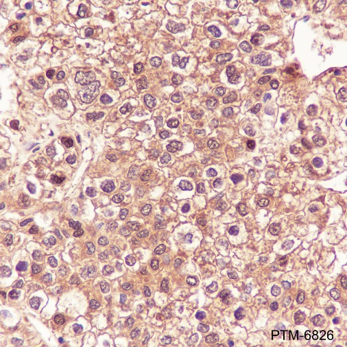Anti-Arginase-1 Rabbit pAb
