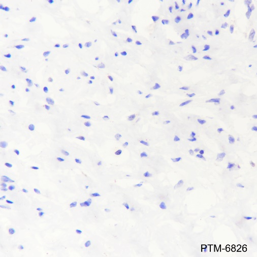 Anti-Arginase-1 Rabbit pAb