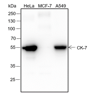 Anti-Keratin 7 Rabbit mAb