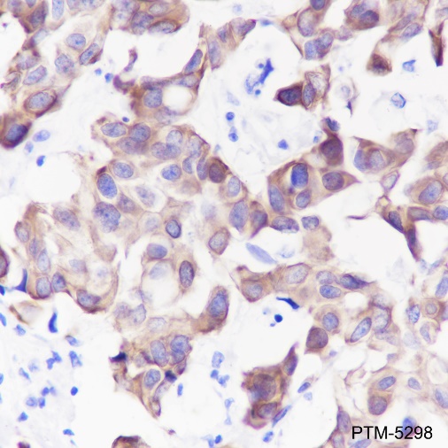 Anti-Keratin 7 Rabbit mAb