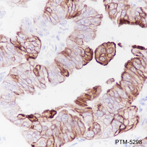 Anti-Keratin 7 Rabbit mAb