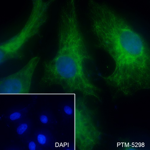 Anti-Keratin 7 Rabbit mAb