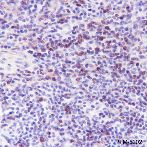 Anti-Bcl-2 Rabbit mAb