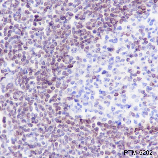 Anti-Bcl-2 Rabbit mAb