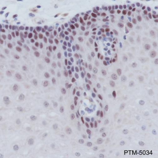 Anti-MSH2 Rabbit mAb