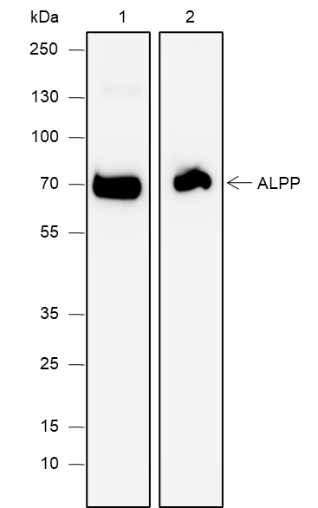 Anti-ALPP Mouse mAb