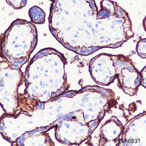 Anti-ALPP Mouse mAb