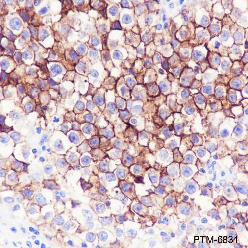 Anti-ALPP Mouse mAb