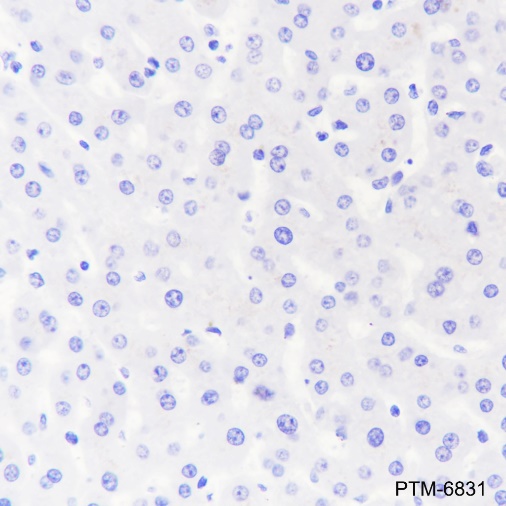 Anti-ALPP Mouse mAb