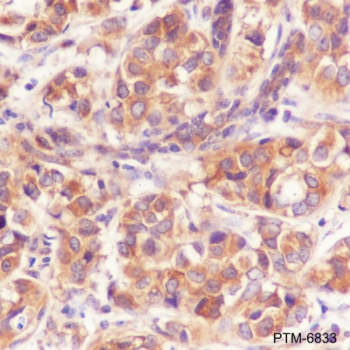 Anti-KIF5B Rabbit mAb