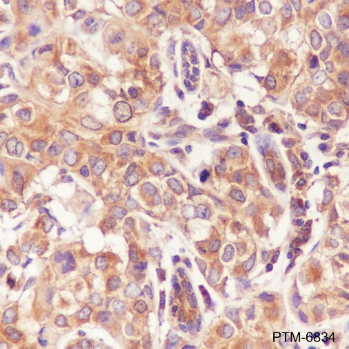 Anti-TNF Receptor II Rabbit mAb