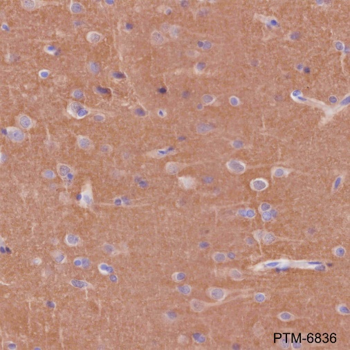 Anti-alpha-Synuclein Rabbit mAb