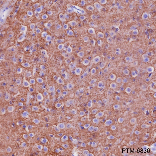 Anti-alpha-Synuclein Rabbit mAb