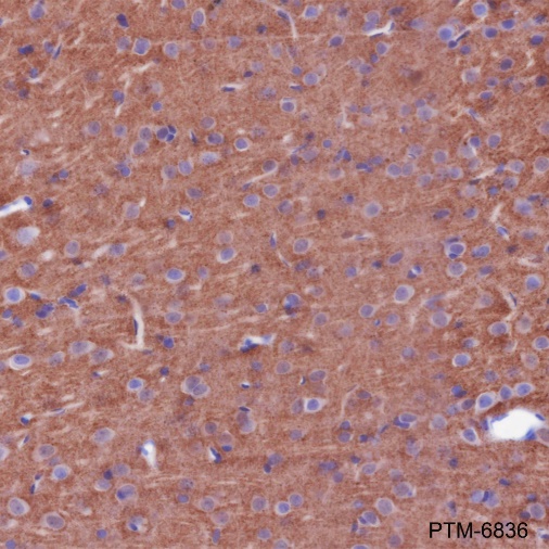 Anti-alpha-Synuclein Rabbit mAb
