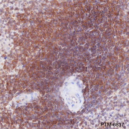 Anti-SHIP-1 Rabbit mAb