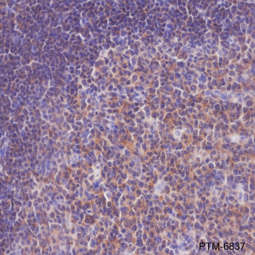 Anti-SHIP-1 Rabbit mAb