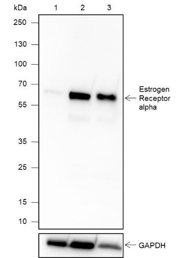 Anti-Estrogen Receptor alpha Rabbit mAb
