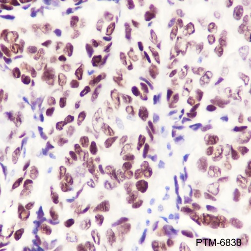 Anti-Estrogen Receptor alpha Rabbit mAb