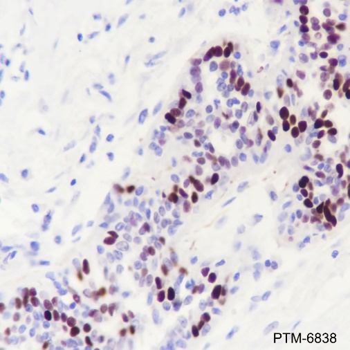 Anti-Estrogen Receptor alpha Rabbit mAb