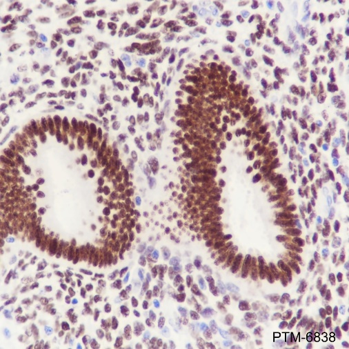 Anti-Estrogen Receptor alpha Rabbit mAb