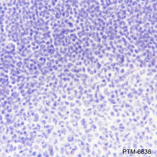 Anti-Estrogen Receptor alpha Rabbit mAb