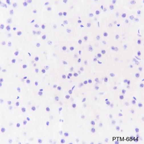Anti-beta-Amyloid (1-40) Rabbit pAb