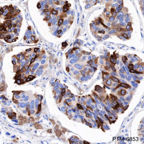 Anti-AGR2 Mouse mAb