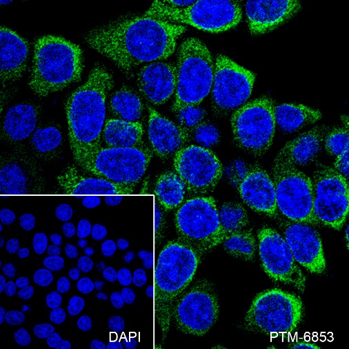 Anti-AGR2 Mouse mAb