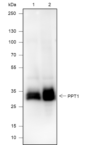 Anti-PPT1 Mouse mAb