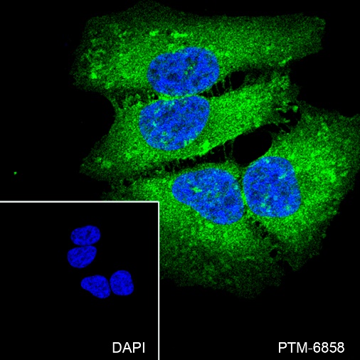 Anti-MYO1C Rabbit mAb