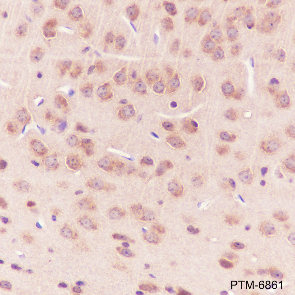 Anti-PGAM1 Rabbit pAb