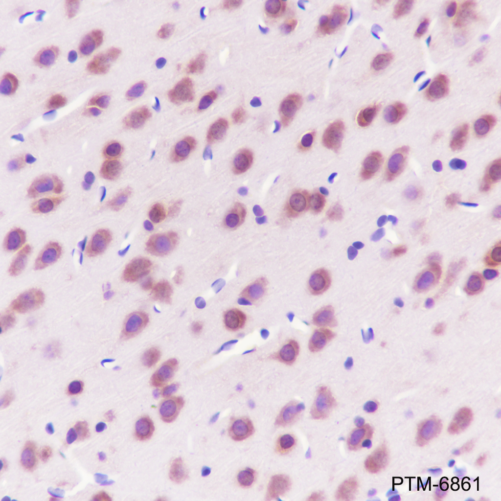 Anti-PGAM1 Rabbit pAb