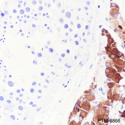Anti-INSL3 Rabbit mAb