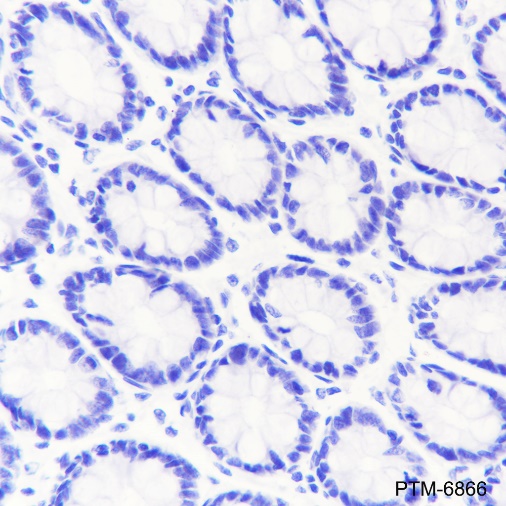 Anti-INSL3 Rabbit mAb