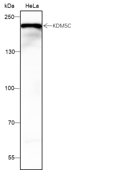 Anti-KDM5C/JARID1C/SmcX Mouse mAb