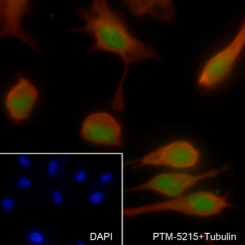 Anti-KDM5C/JARID1C/SmcX Mouse mAb