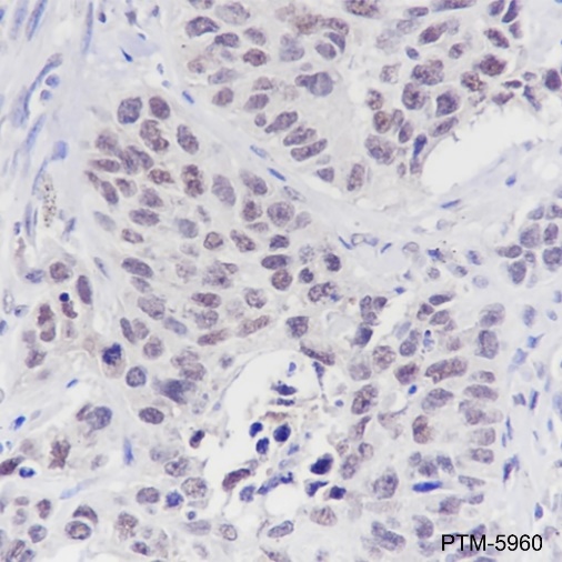 Anti-LSD1 Mouse mAb