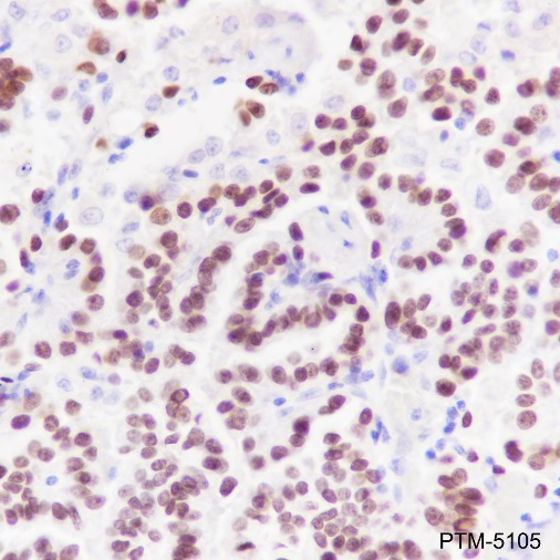 Anti-TTF1 Rabbit mAb
