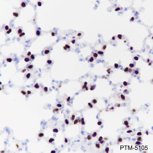 Anti-TTF1 Rabbit mAb