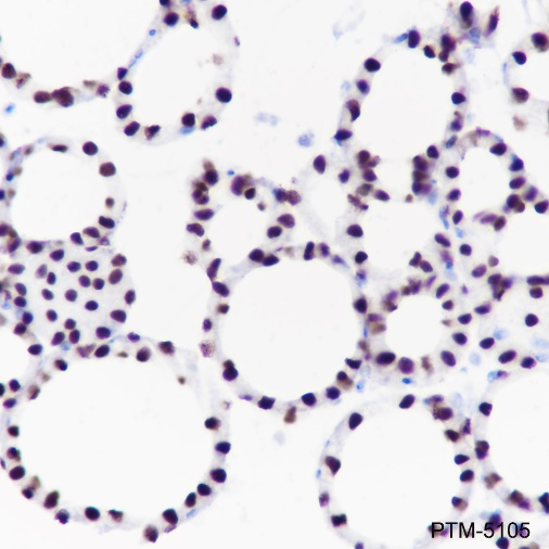 Anti-TTF1 Rabbit mAb