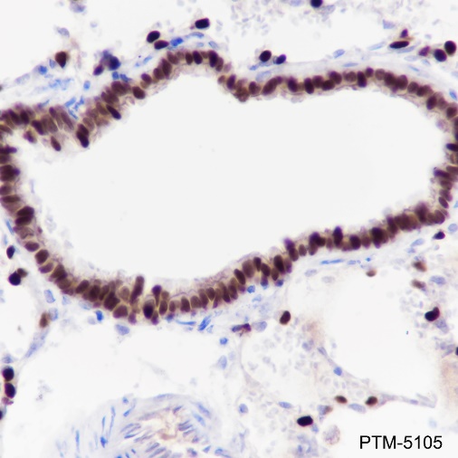 Anti-TTF1 Rabbit mAb