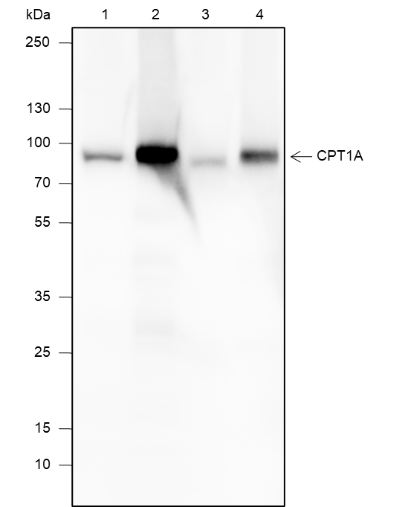 Anti-CPT1A Mouse mAb