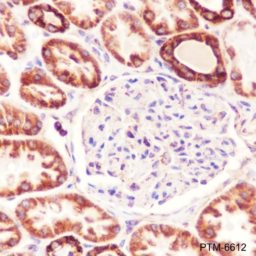 Anti-CPT1A Mouse mAb