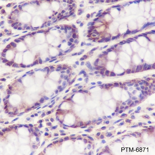 Anti-Tec Rabbit mAb