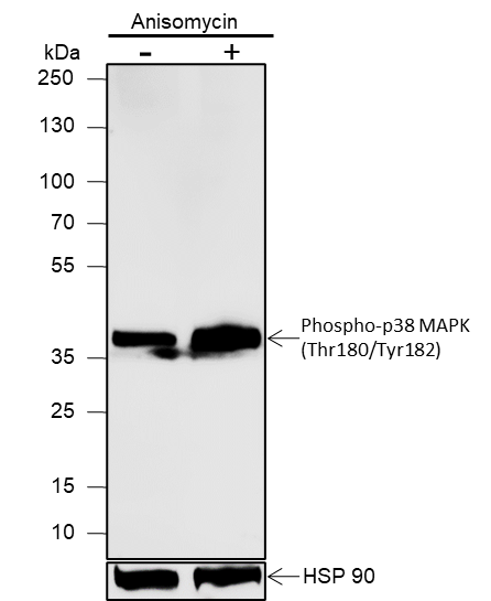 Anti-Phospho-p38 MAPK (Thr180/Tyr182) Rabbit mAb