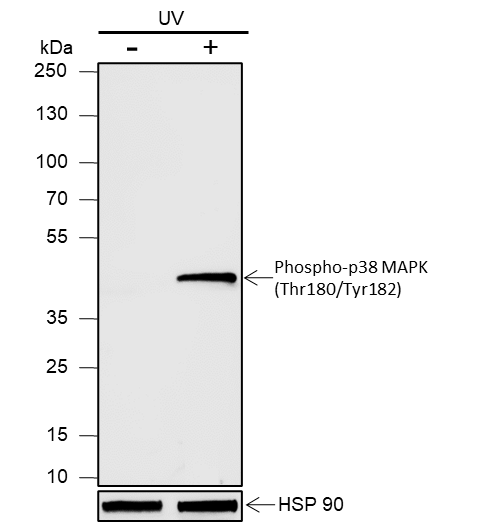Anti-Phospho-p38 MAPK (Thr180/Tyr182) Rabbit mAb