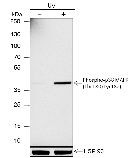 Anti-Phospho-p38 MAPK (Thr180/Tyr182) Rabbit mAb