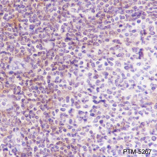 Anti-VPAC2 Rabbit mAb