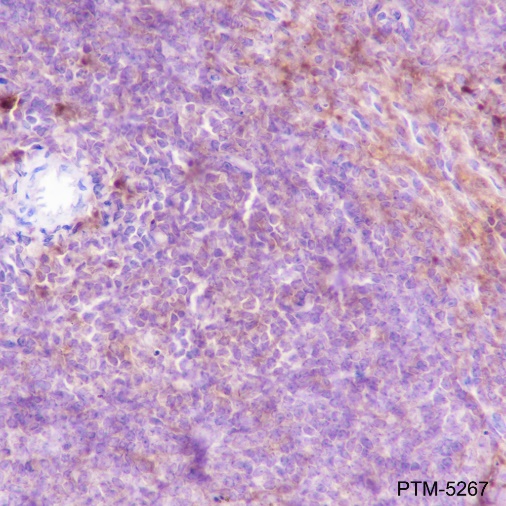 Anti-VPAC2 Rabbit mAb