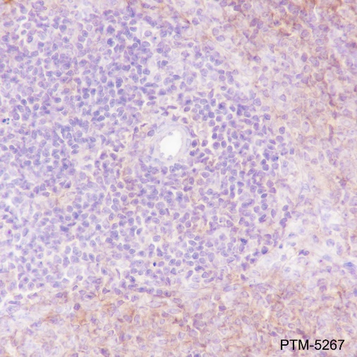 Anti-VPAC2 Rabbit mAb
